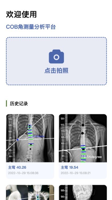 cobb角测量分析平台