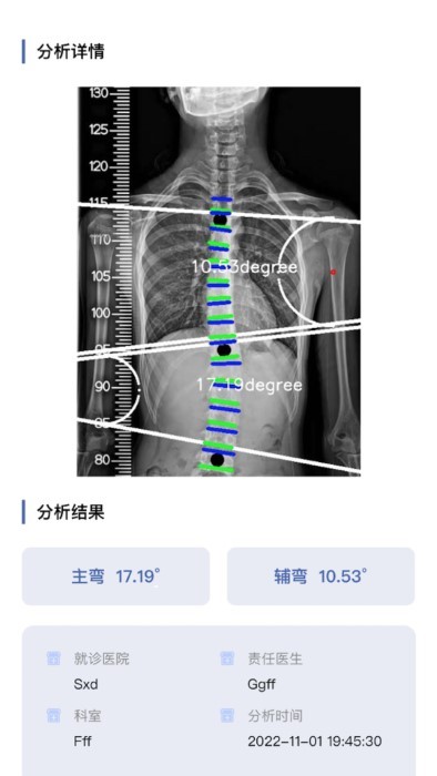 cobb角测量分析平台